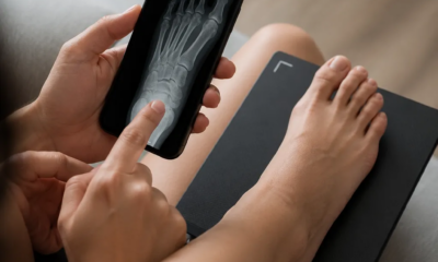 Raio-X pelo Android: Como Fazer em Casa