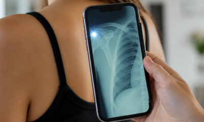 App Raio-X iPhone com flash realista: diversão garantida agora