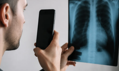 Descubra o Efeito de Raio-X Direto no Celular
