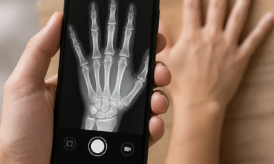 Aplicativo de Raio X pela Câmera do Android Funciona Mesmo