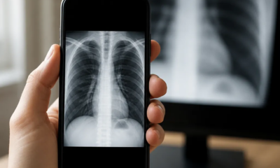 Aplicativo de raio x para android que simula radiografia real