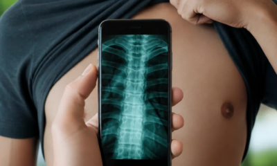 App de raio-X pela câmera do Android que surpreende médicos e amigos