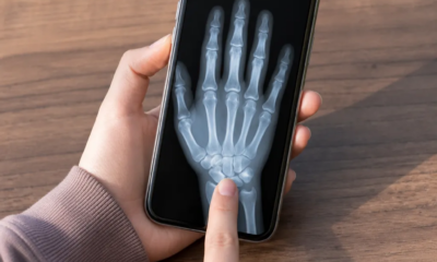 Simulador de Raio-X para Android: Veja Como Funciona Grátis