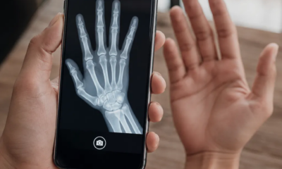 Como Simular Raio-X pela Câmera do Seu Celular em Minutos