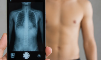 Veja dentro do corpo com câmera do seu celular agora