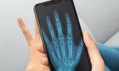 Simulador de Raio-X no iPhone: Brincadeira Divertida e Segura