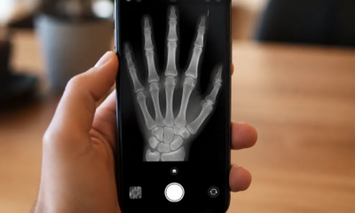 Como usar raio-x na câmera do iphone agora