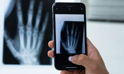 Câmera do iPhone como raio x profissional em segundos