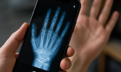 Como Simular Raio-X no iPhone com Esta Ferramenta