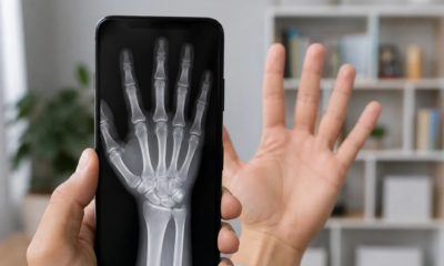 Como Simular Raio-X pela Câmera do Celular